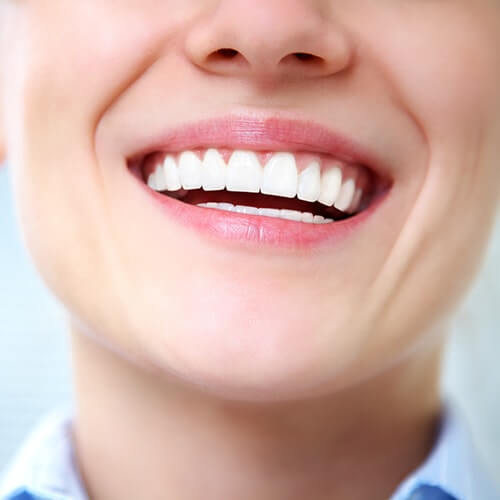 closeup of a bright, white smile