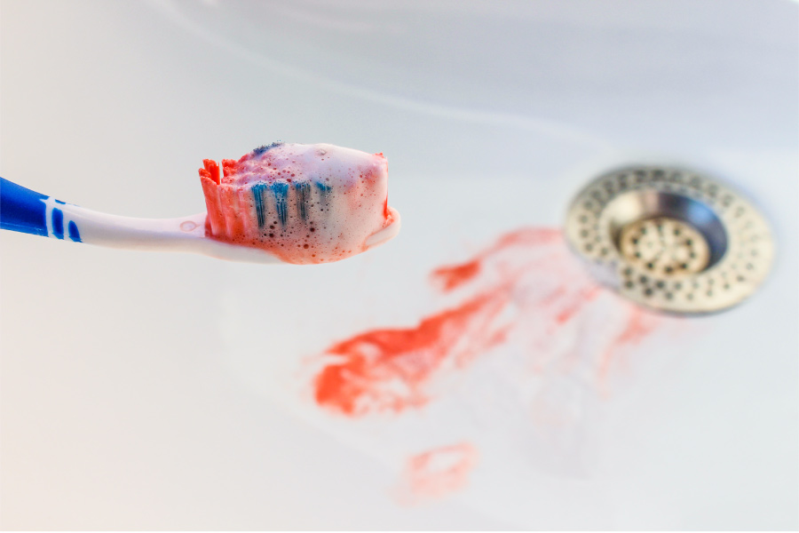 Closeup of a toothbrush with blood on it over a sink with blood from bleeding gums that have gum disease